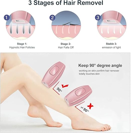 Laser Hair Removal – جهاز إزالة الشعر بالليزر